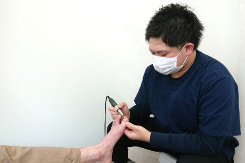 Ingrown-Nail-Beauty-Salon-Sendai-City